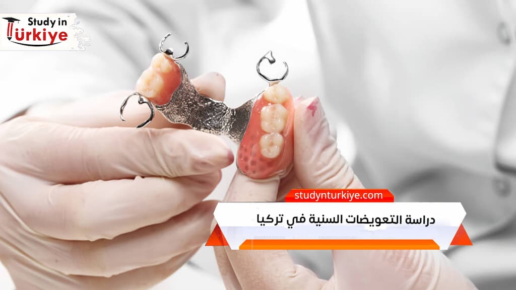 دراسة التعويضات السنية في تركيا